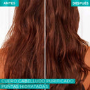 ACONDICIONADOR ELVIVE HIALURONICO PURE 200ML
