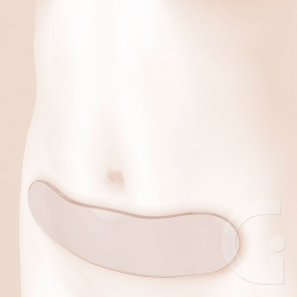 Lámina De Gel Post Cirugía Abdominal | Gelform